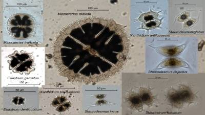 Chorophyta s.l  Zygnematophyceae: Desmidiales, varias especies. Autor: María Verdugo (CEDEX)
