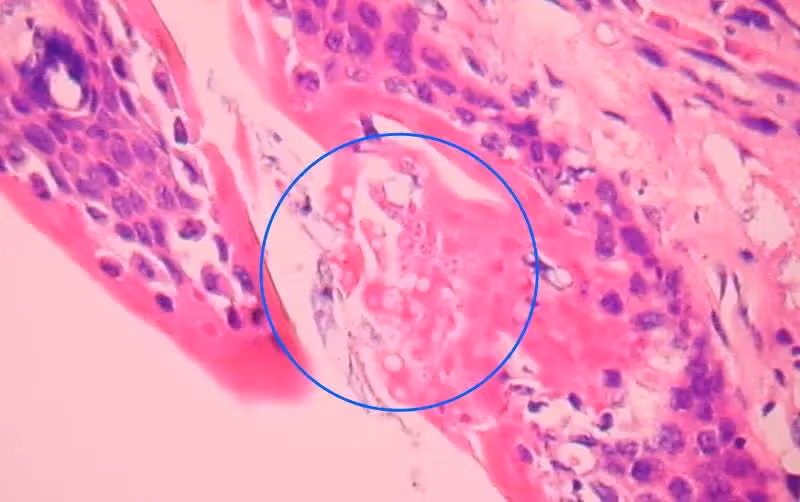 corte histologico
